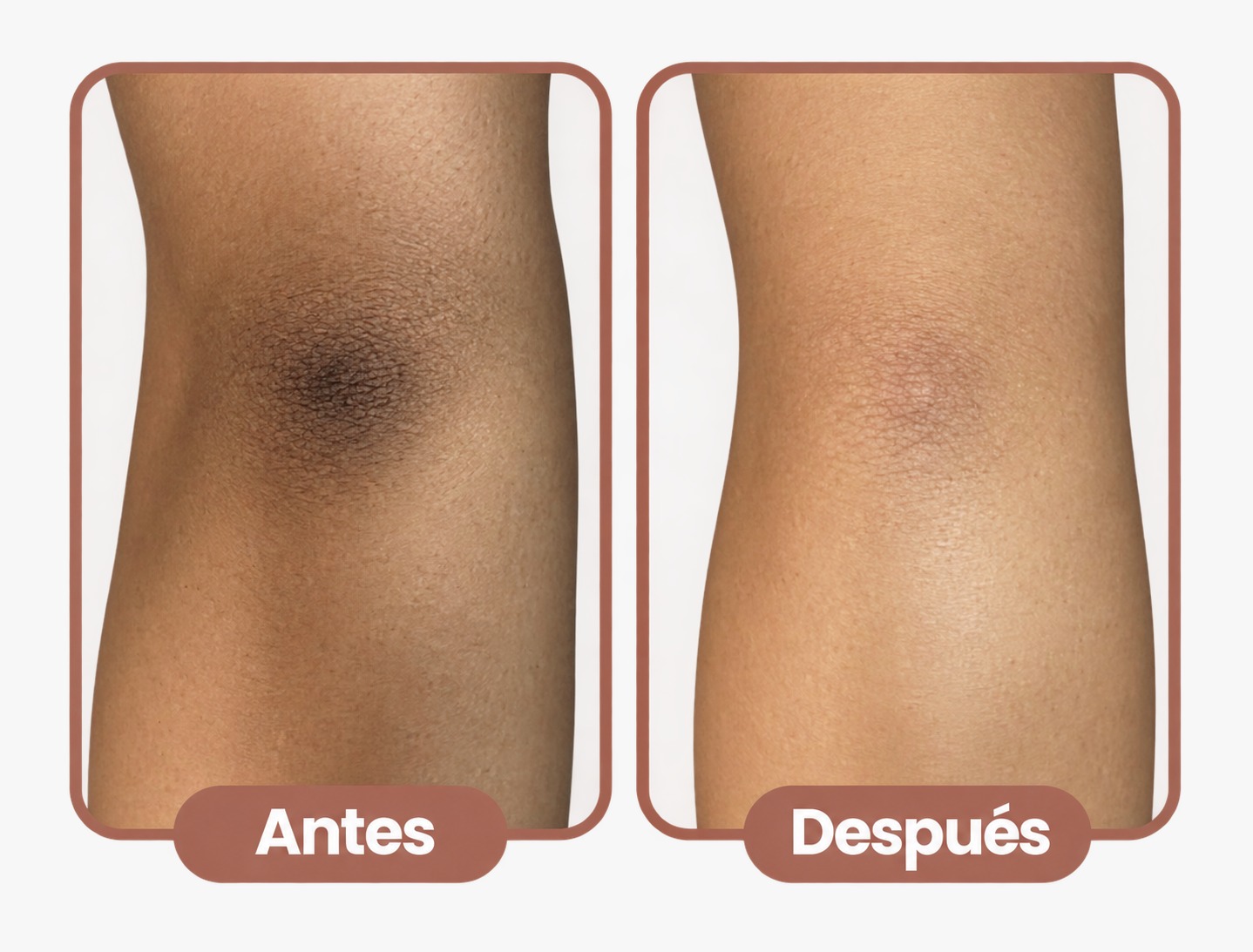 Antes y después de aclaramiento corporal